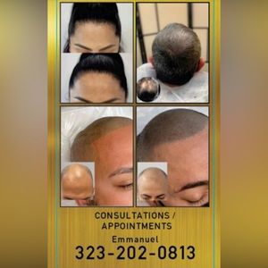 Hairloss solution